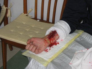 Durch die hervorragende Schminkarbeit vom RK Kilb konnte sehr realistisch ge&uuml;bt werden.